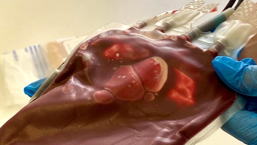 В Мордовии – пять тысяч Почётных доноров России