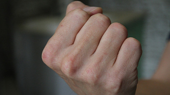 Житель Саранска ударил незнакомца бутылкой по голове